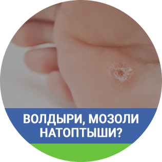 Волдыри